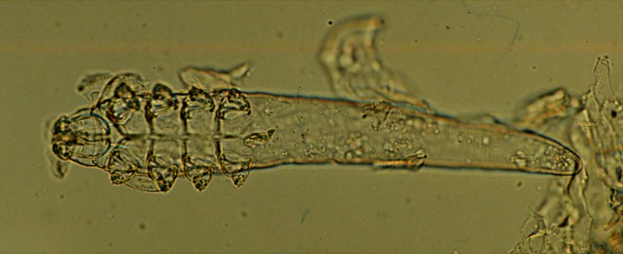 Demodex mite