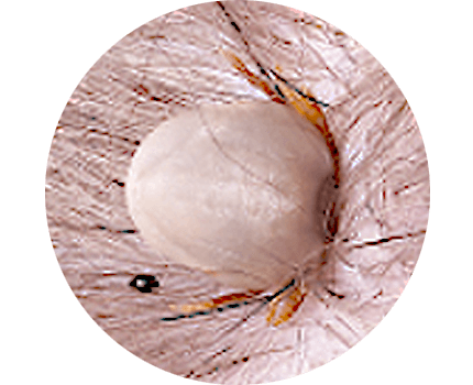 Australian Paralysis Tick Engorged
